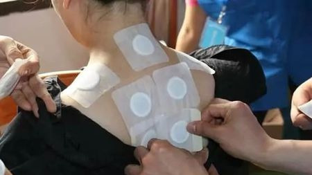 三伏贴究竟有没有科学原理?