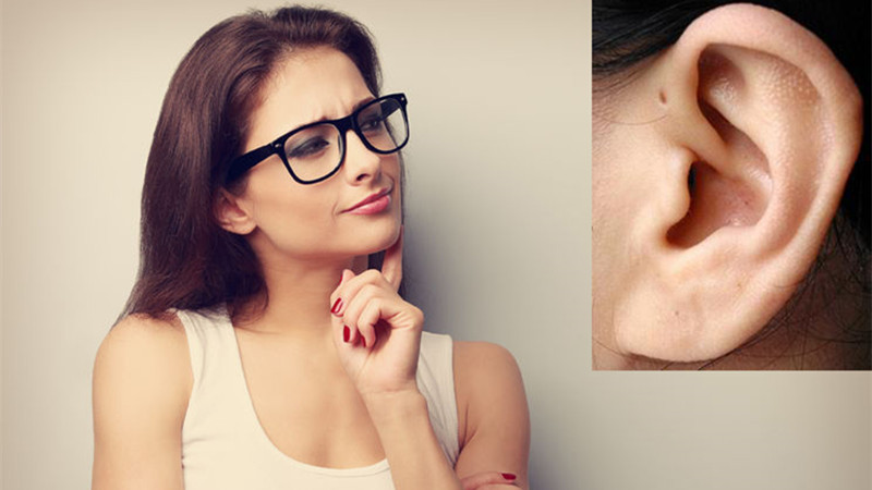 聪明孔!耳朵上的小孔到底是什么?