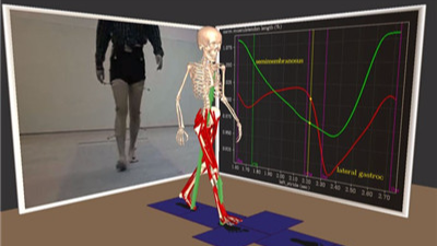 记性不好就是阿尔兹海默病?请走两步检测一下