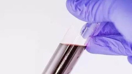 骨髓移植,会影响捐献者的健康吗?