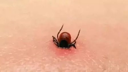 夏日小虫威力大,被咬伤严重会丧命!