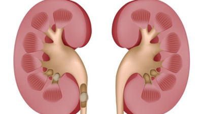 切除一个肾后能活多久?