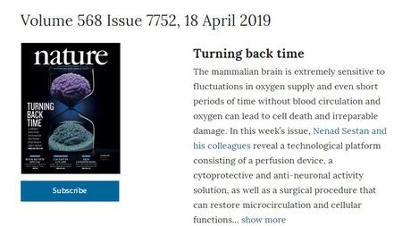 重新定义生死?科学家让死亡几小时后的大脑恢复细胞功能