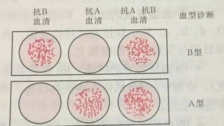 A型、B型、AB型······你知道人为什么有不同的血型吗?