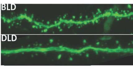 感觉自己变傻了?也许是光照不够