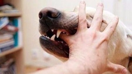 被健康的狗咬伤,需不需要打狂犬疫苗?