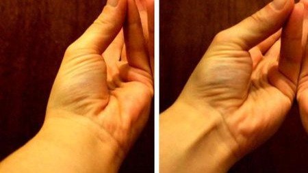 人体最常见的变异:25%的人手臂里都少了一块肌肉