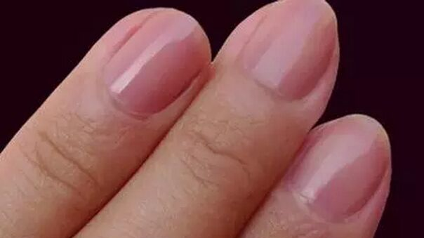 指甲上的“小月牙”是健康晴雨表?